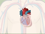 سندرم ایزن‌منگرچیست؟ (Eisenmenger Syndrome)- قسمت اول