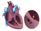 تغییرات فیزیولوژیک بارداری و تأثیر آن بر سندرم ایزن‌منگر- قسمت دوم